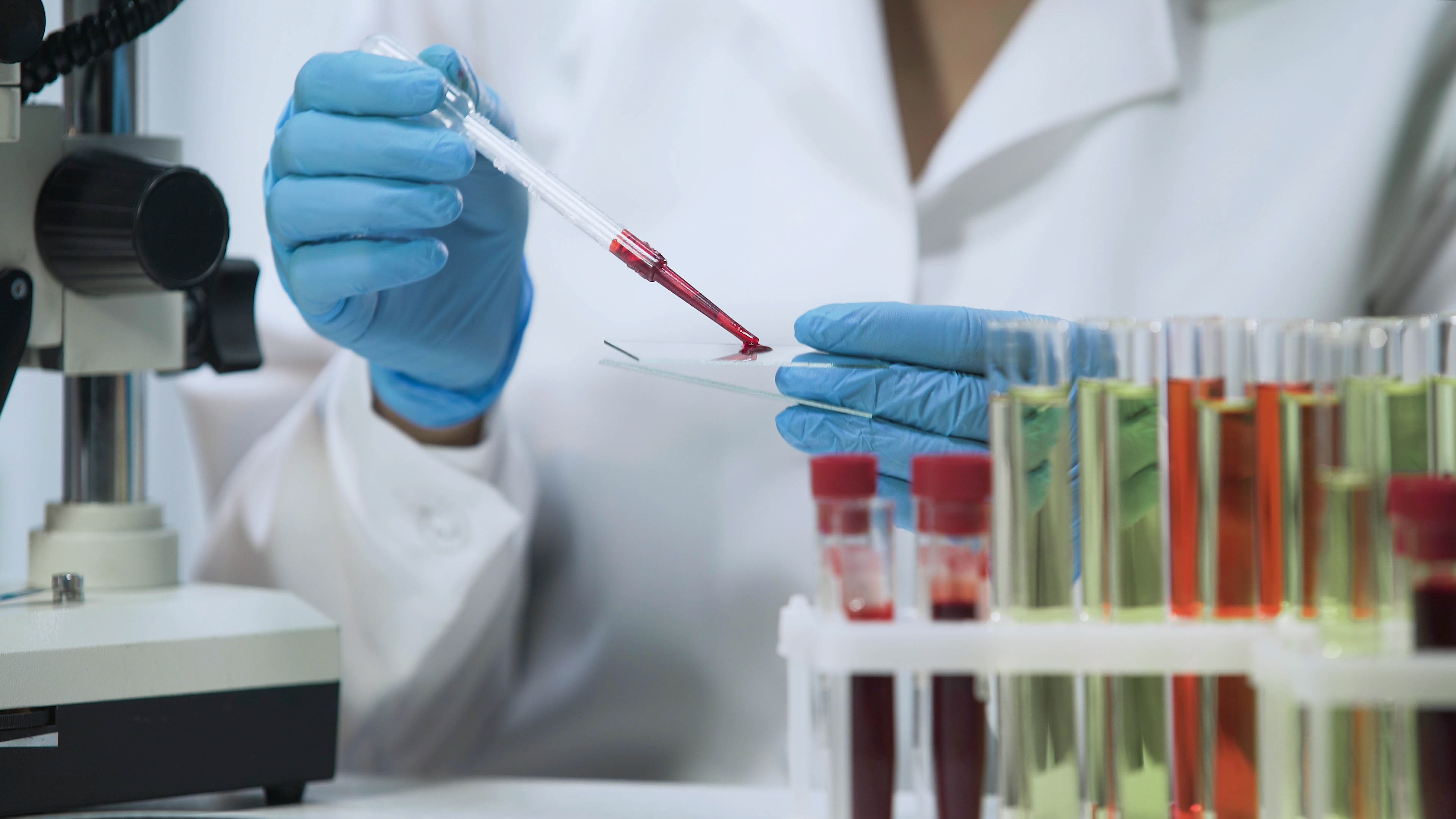 A laboratory technician handling a blood sample with a pipette. 