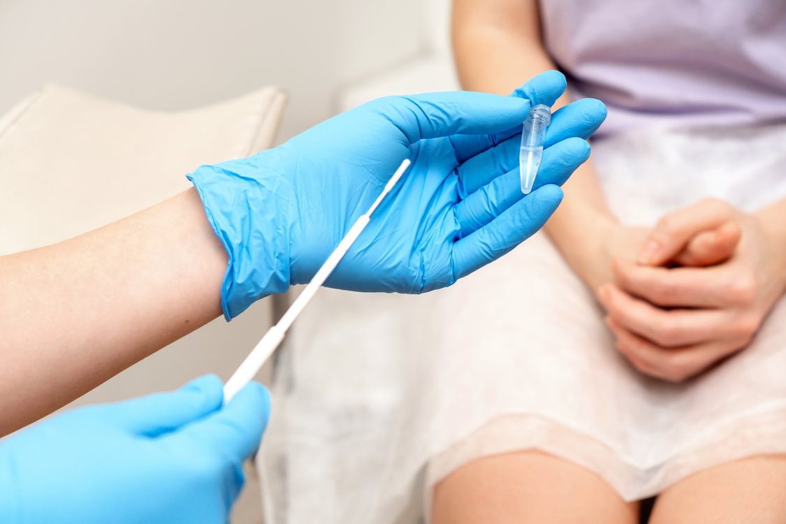 a medical professional with blue gloves holds an STI test