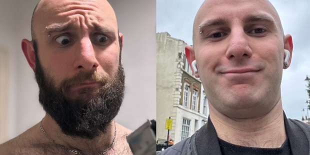 Before and after of a bearded and clean shaven man.