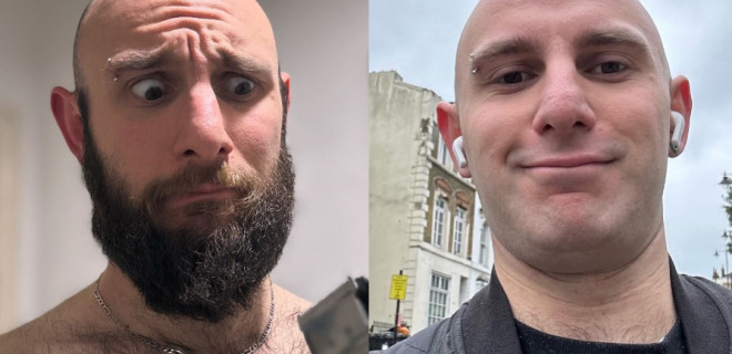Before and after of a bearded and clean shaven man.