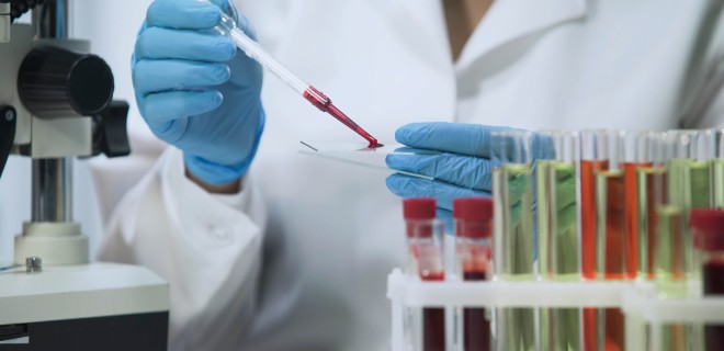 A laboratory technician handling a blood sample with a pipette. 