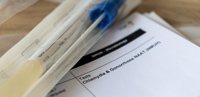 Gonorrhoea and chlamydia test.