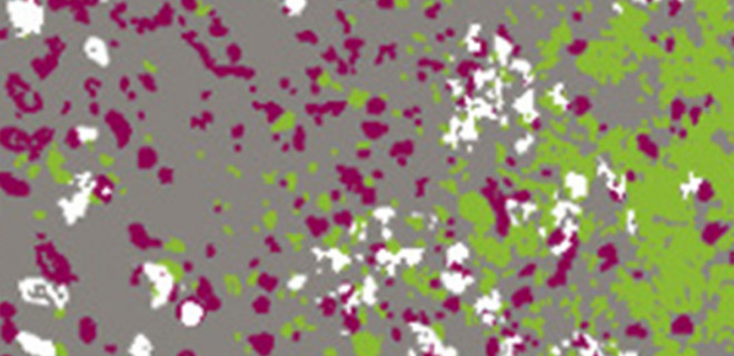 Microscopic image of LGV