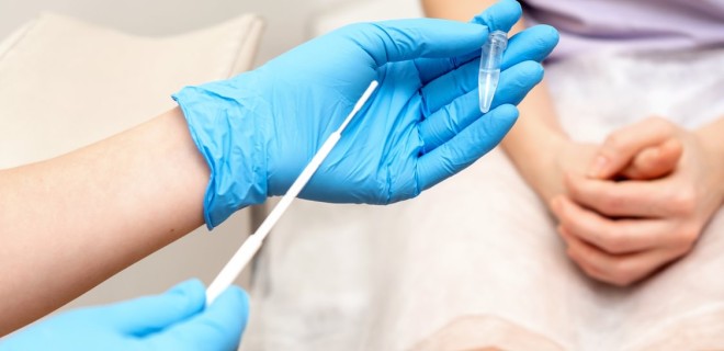 a medical professional with blue gloves holds an STI test 