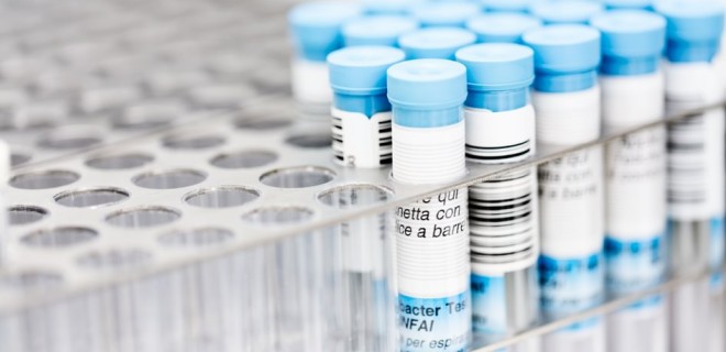 A bunch of tests held up in vials.