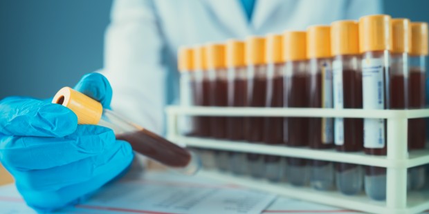 A gloved hand holding a vial of blood whilst many others are lined up on a table.