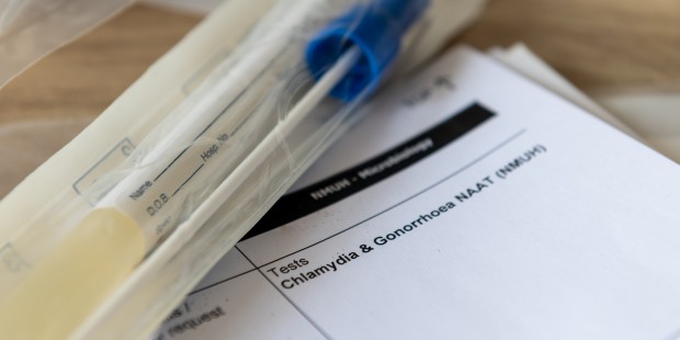 Gonorrhoea and chlamydia test.