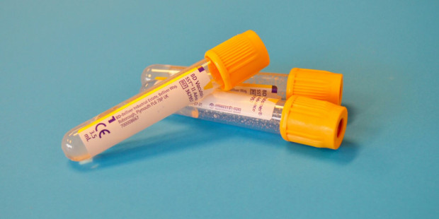 A set of closed vials.